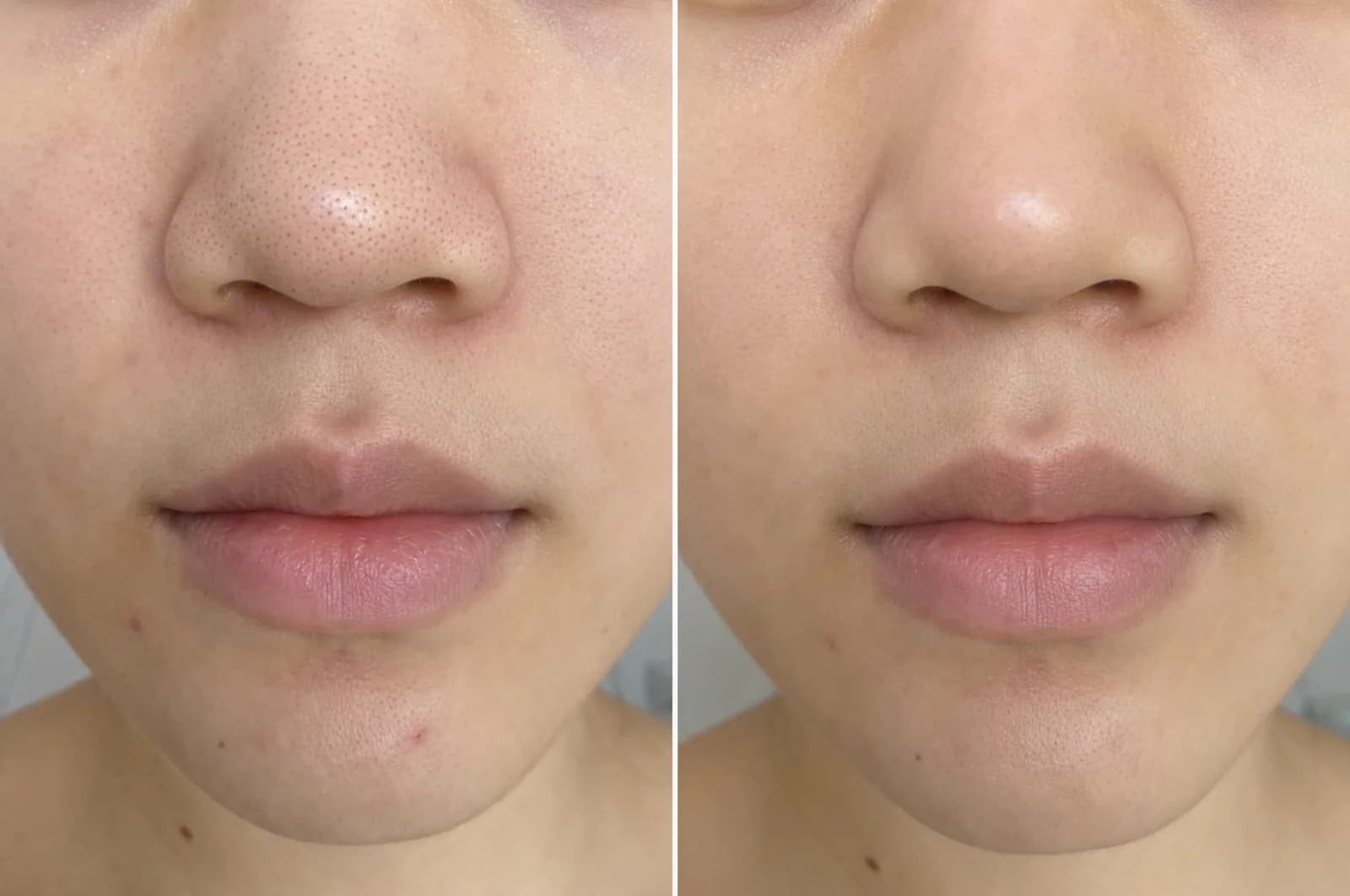 Deep-cleansing facial